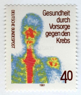 марка ФРГ 40 пфенниг "Scintigram showing distribution of Radioactive Isotope" 1981 год
